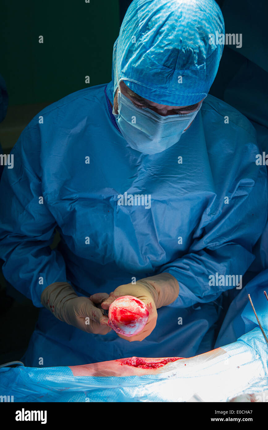 Hip prosthesis, surgery Stock Photo