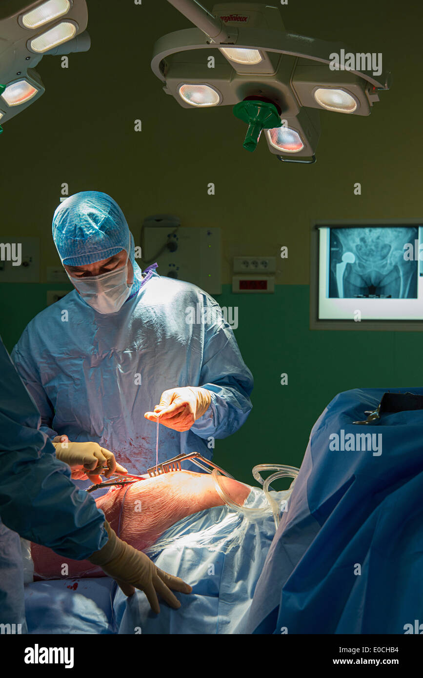 Hip prosthesis, surgery Stock Photo