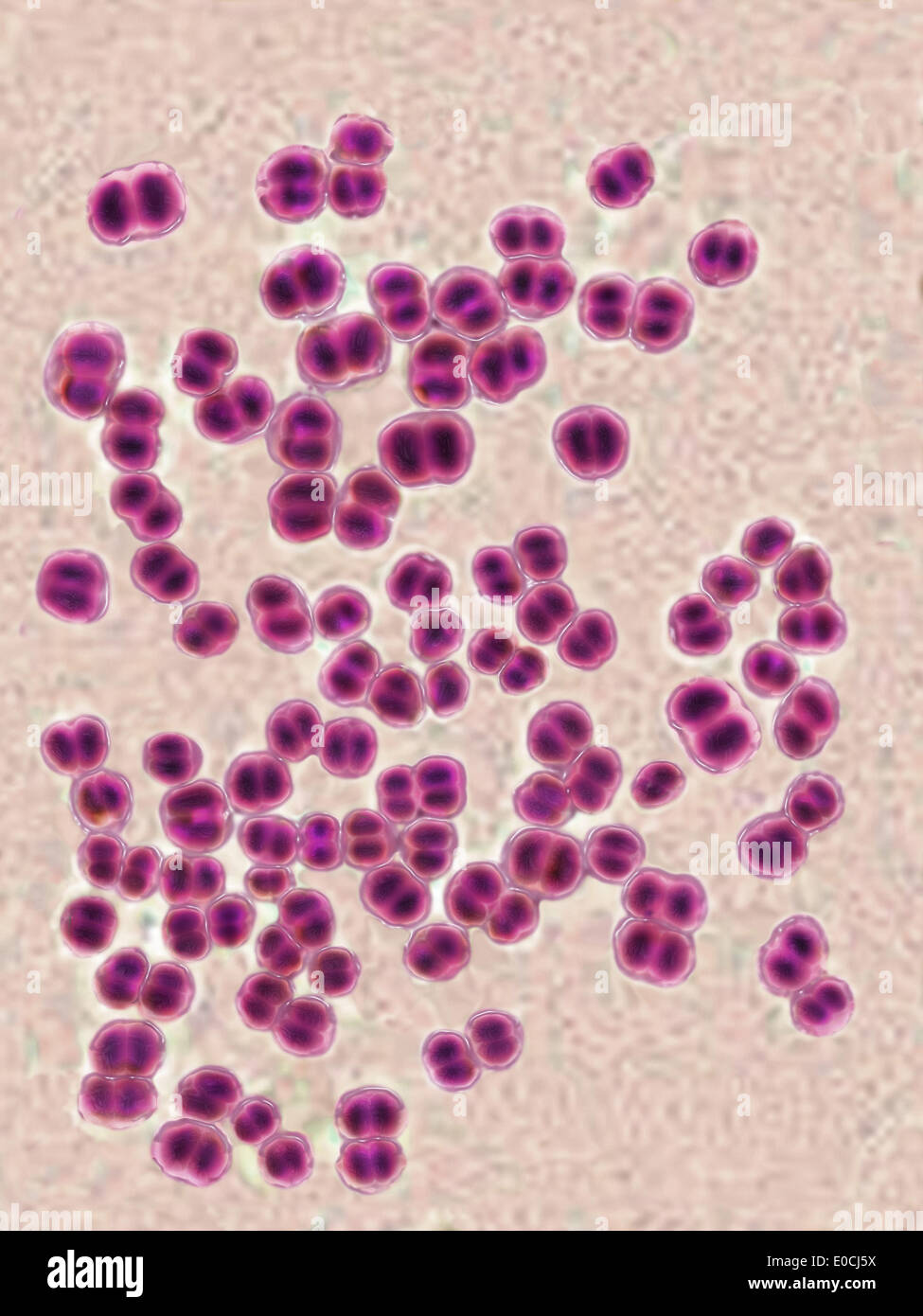 Neisseria Meningitis Gram Stain