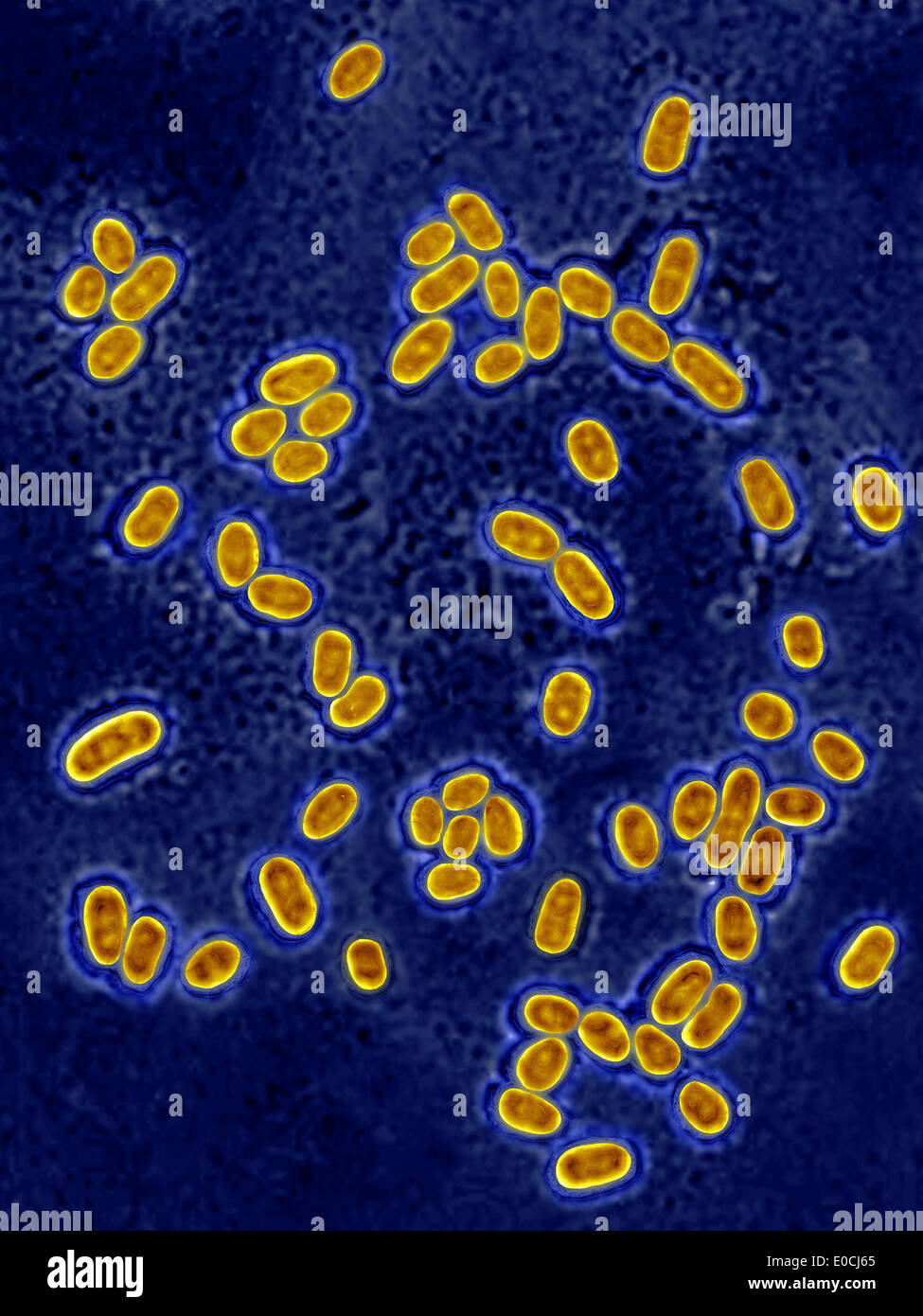 Streptococcus pneumoniae Stock Photo