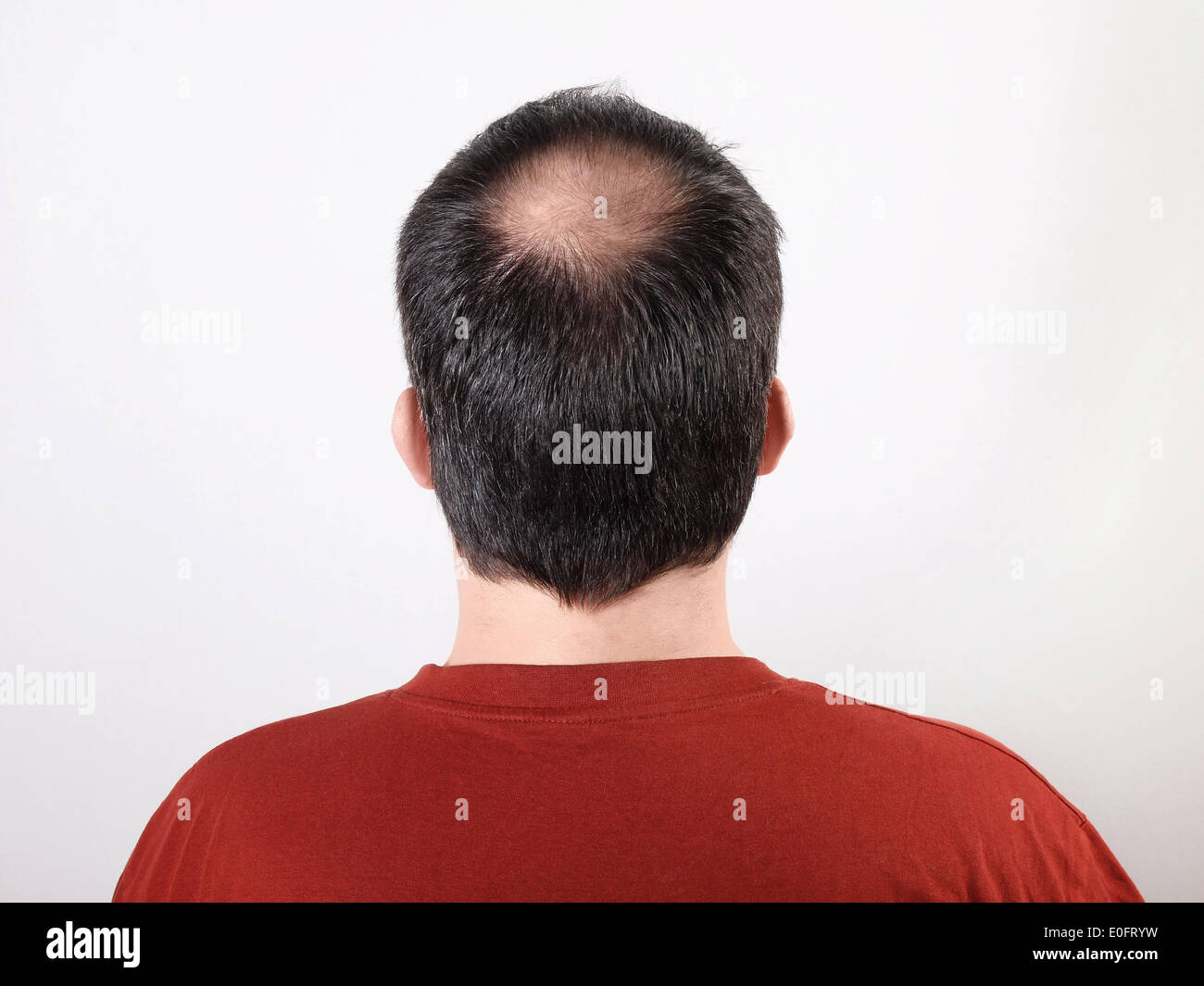 Receding Hair Stock Photos Receding Hair Stock Images Alamy