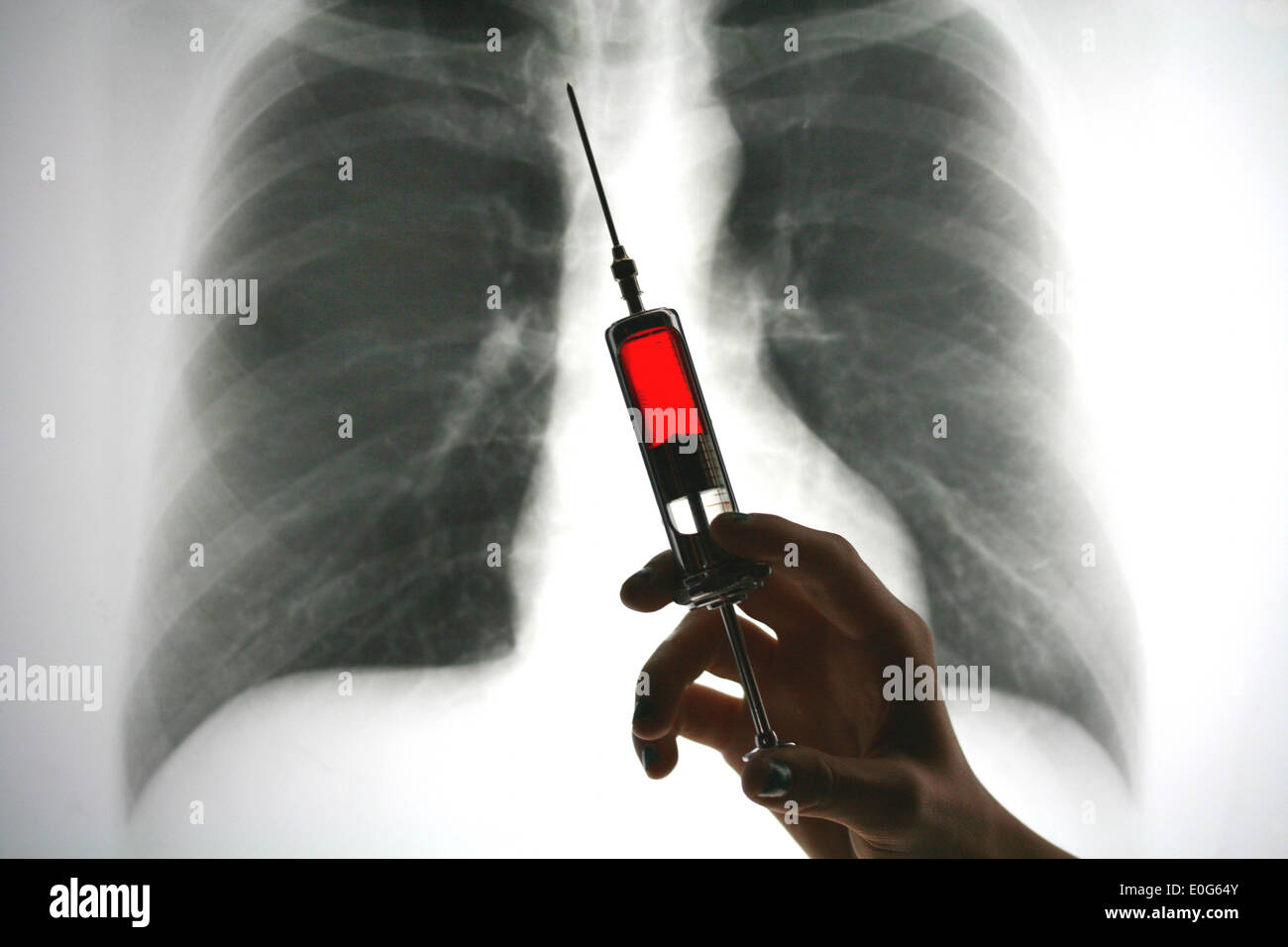 Lung X-ray examination with syringe Stock Photo