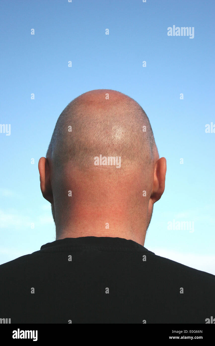 Bald Head Hairs Population Population To Figure Figures