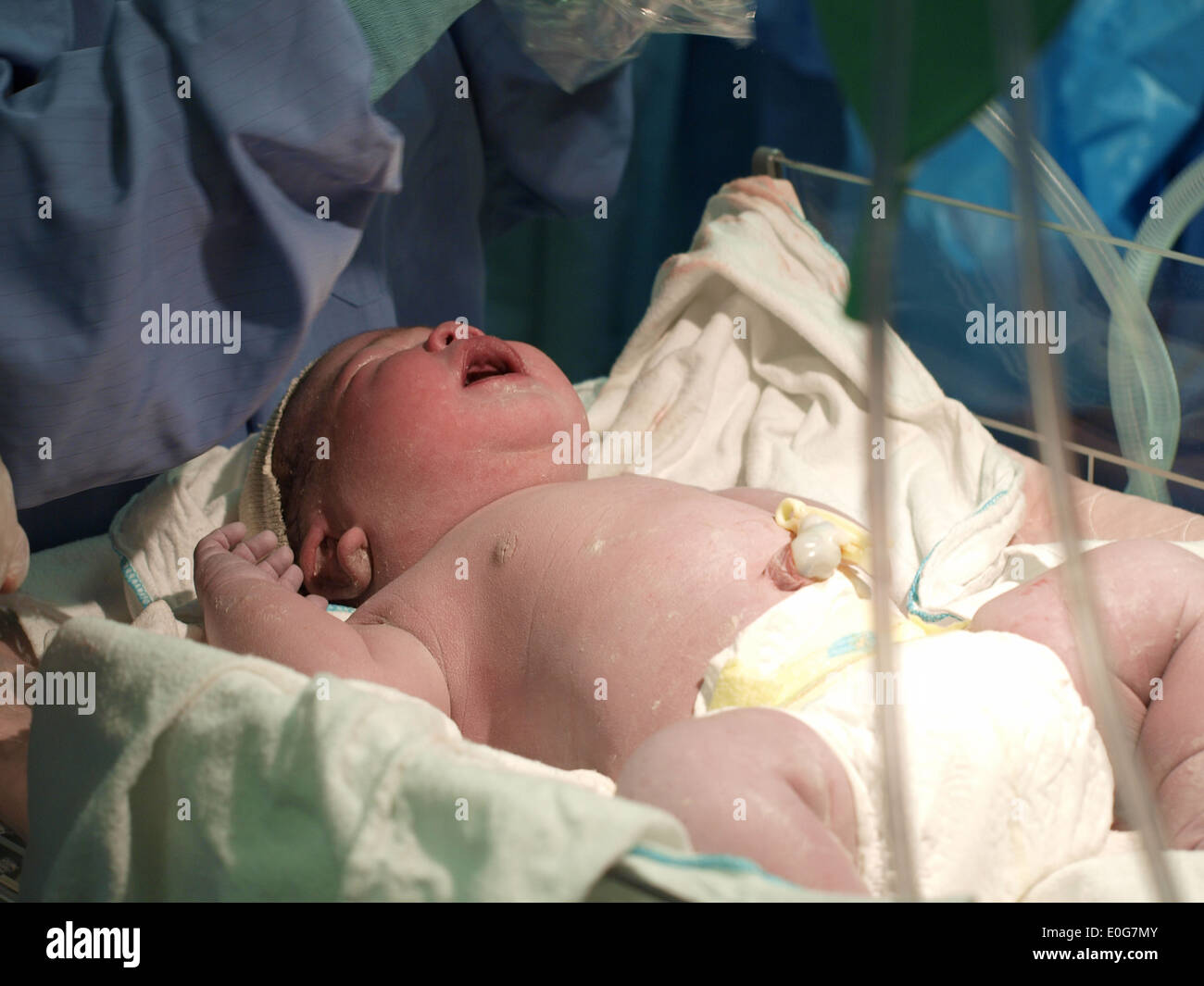 Gestational Age Hi res Stock Photography And Images Alamy