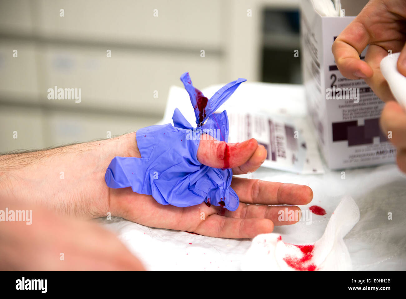 Flesh wound Stock Photo