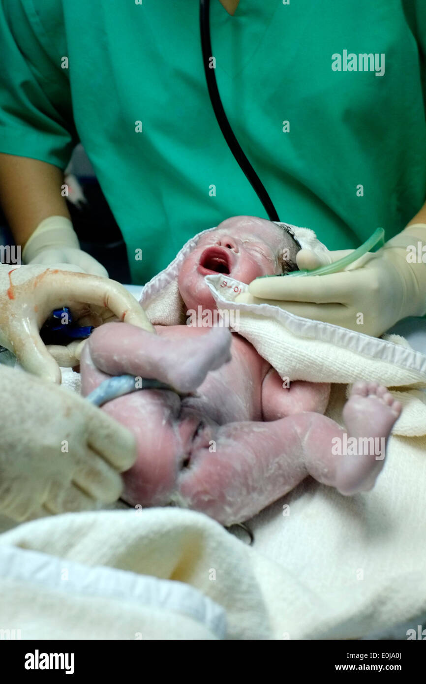 doctors and surgeons assist newborn baby to take first breath during