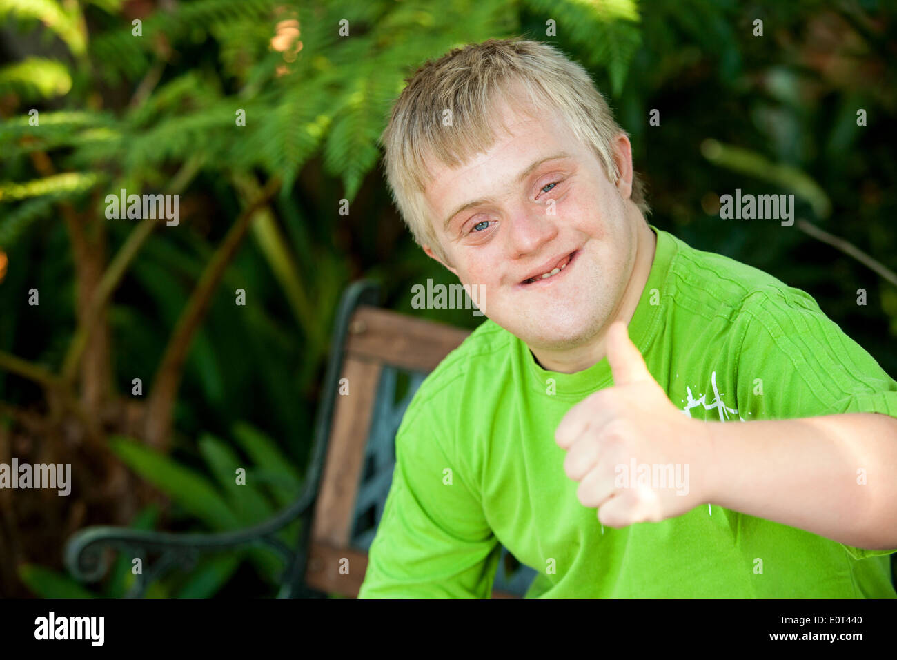 Close up portrait of cute handicapped boy showing thumbs up outside. Stock Photo