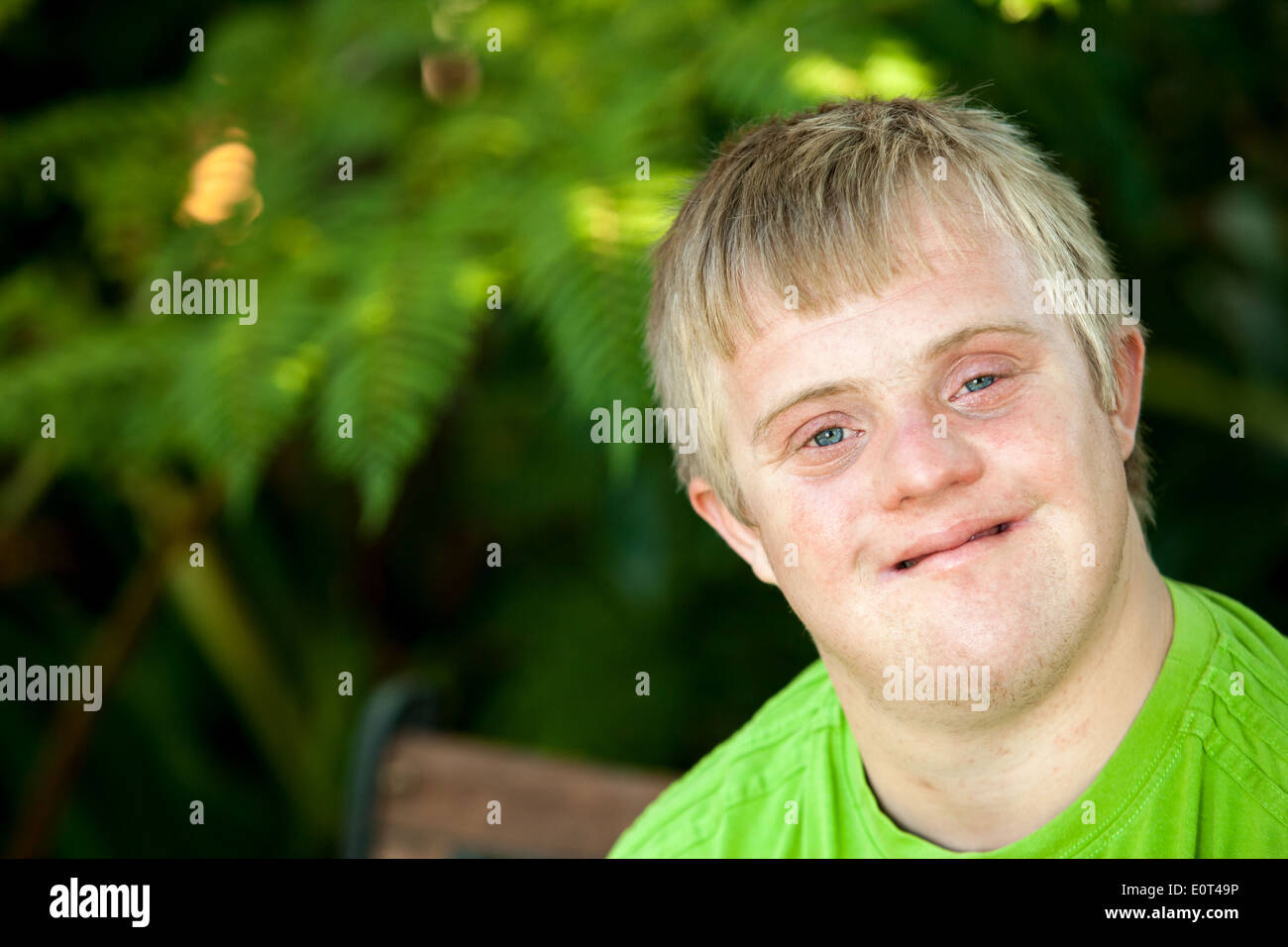 Close up face shot of friendly handicapped boy outdoors. Stock Photo