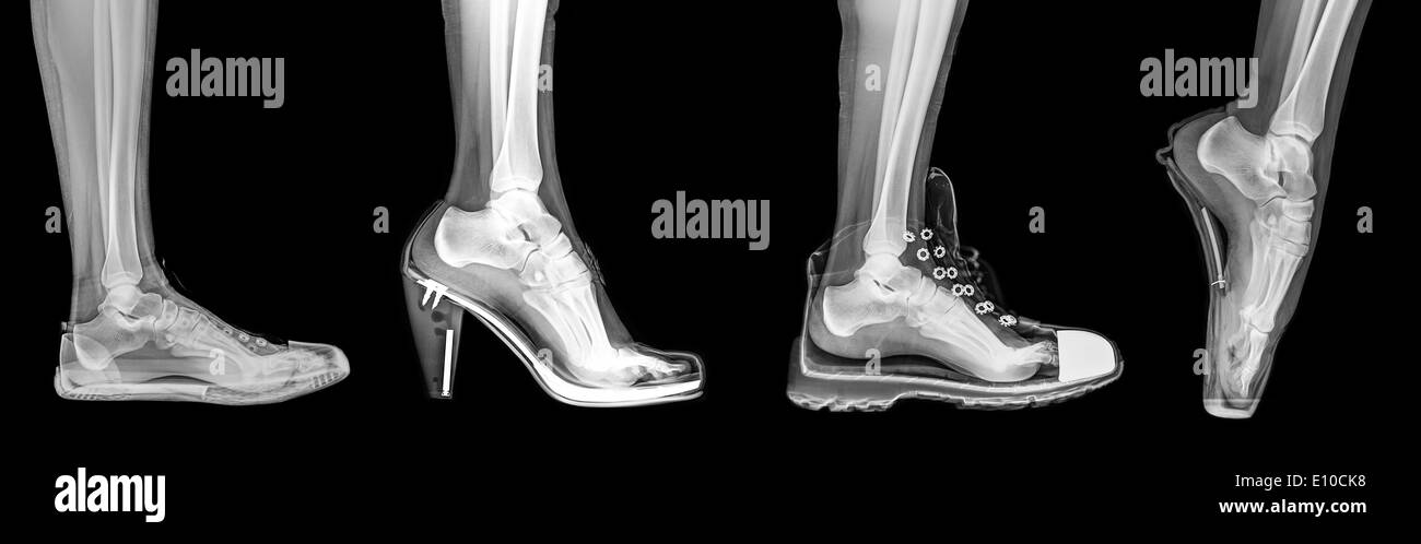 X-ray of a woman's foot in 4 different shoes (from left to right) Trainers, High Heel, Running and Ballet Stock Photo