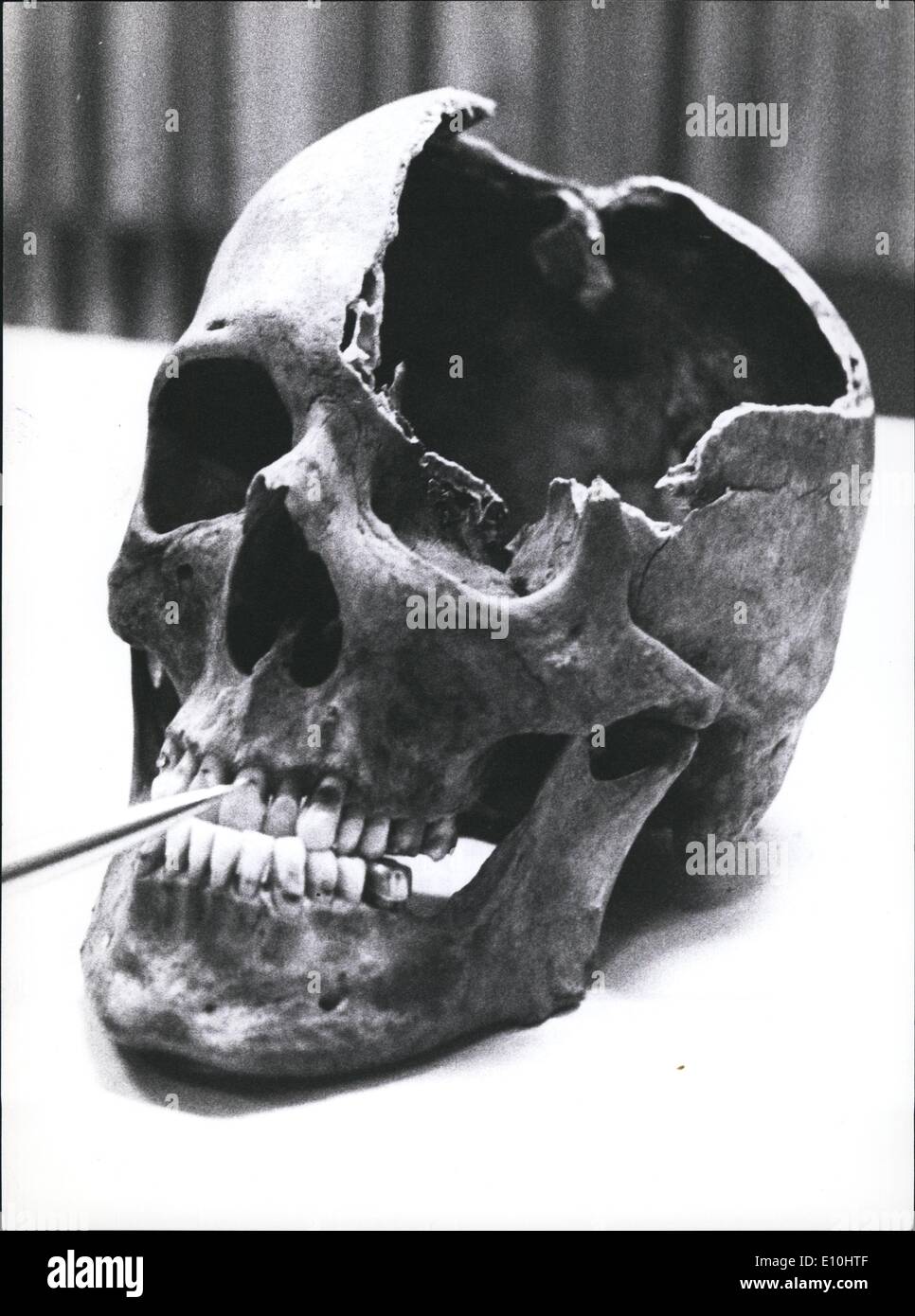Dec. 12, 1972 - New trace in the case of ''Reichseiter'' Martin Bormann ? : Two bones, a skull and upper thigh were found in excavations in Berlin, Lehrt Station. At this place Martin Bormann, the ''substitute'' of Adolf Hitler is said to be killed on his flight 1945. The Francfort public prosecutor's office sent the dental mould of the Nazi leader to Berlin. Photo shows The skull with well-conserved teeth. Stock Photo