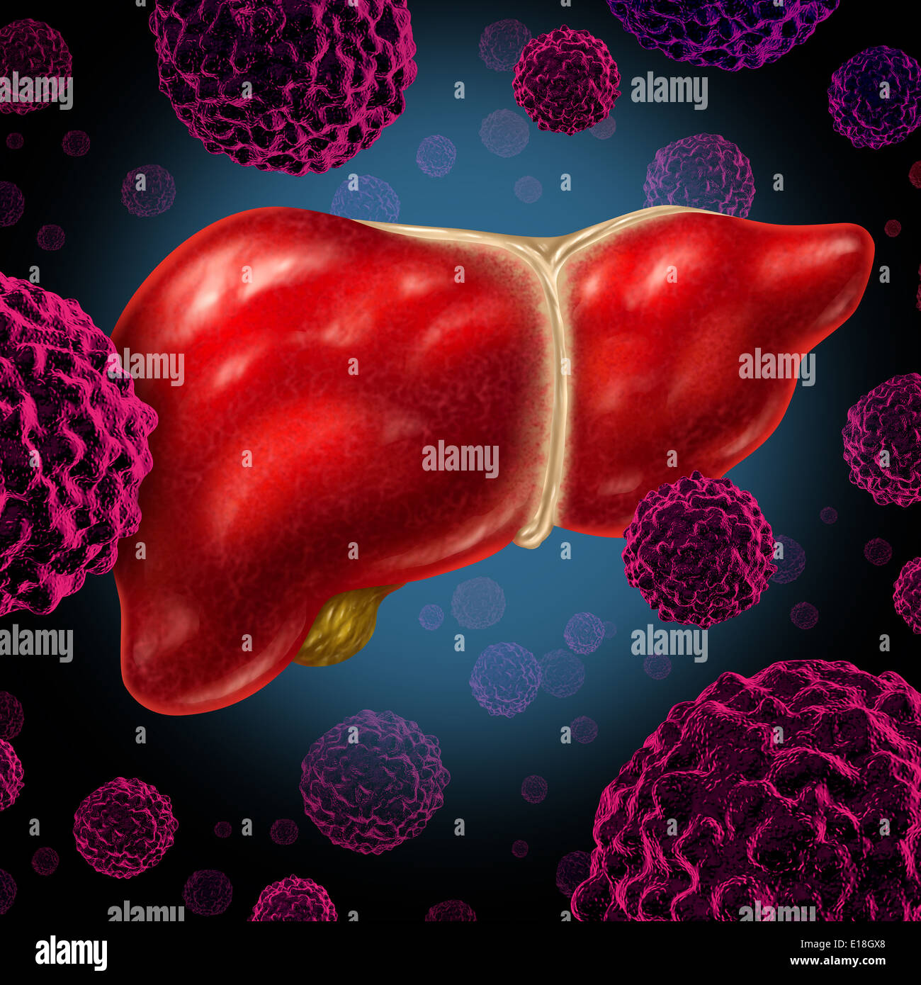 Human liver cancer organ as a medical symbol of a malignant tumor red cell disease as a cancerous growth spreading through the digestive system by alcohol and other environmental toxic reasons. Stock Photo