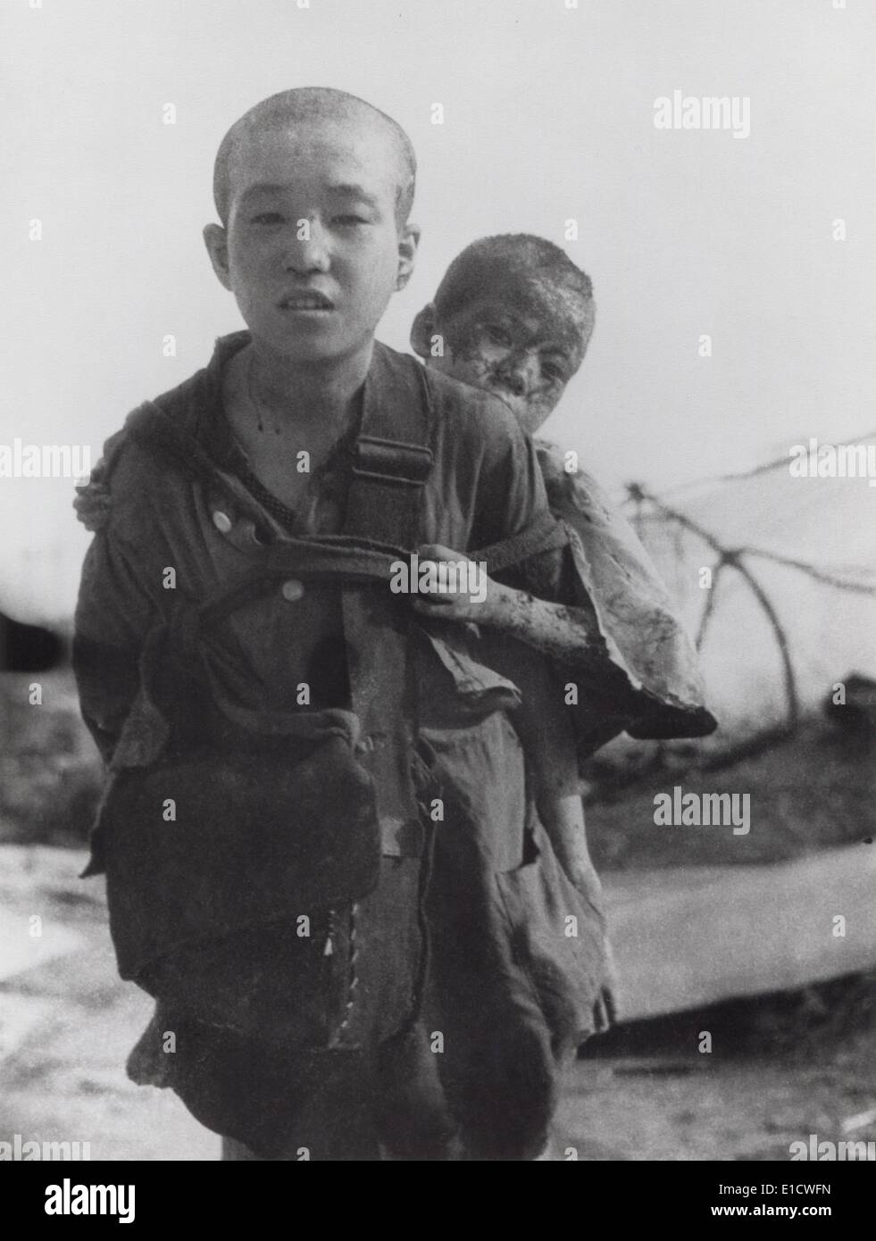 Two brothers who survived the blast of the Nagasaki atomic bomb of Aug. 9, 1945. Japan. Photo taken by Yosuke Yamahata the Stock Photo