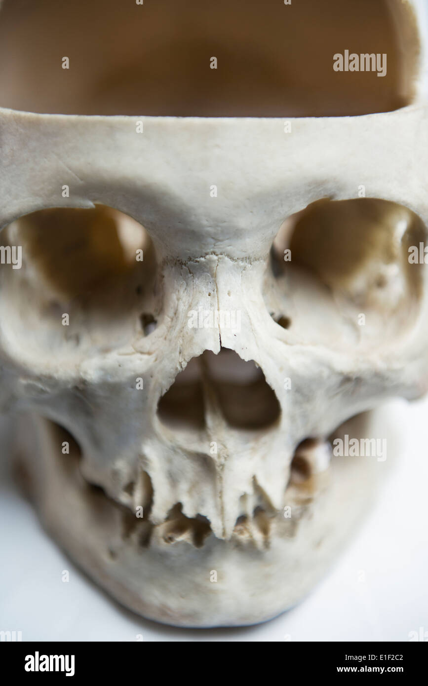 Genuine Human Skull with  front quarter removed used for Medical Studies Stock Photo