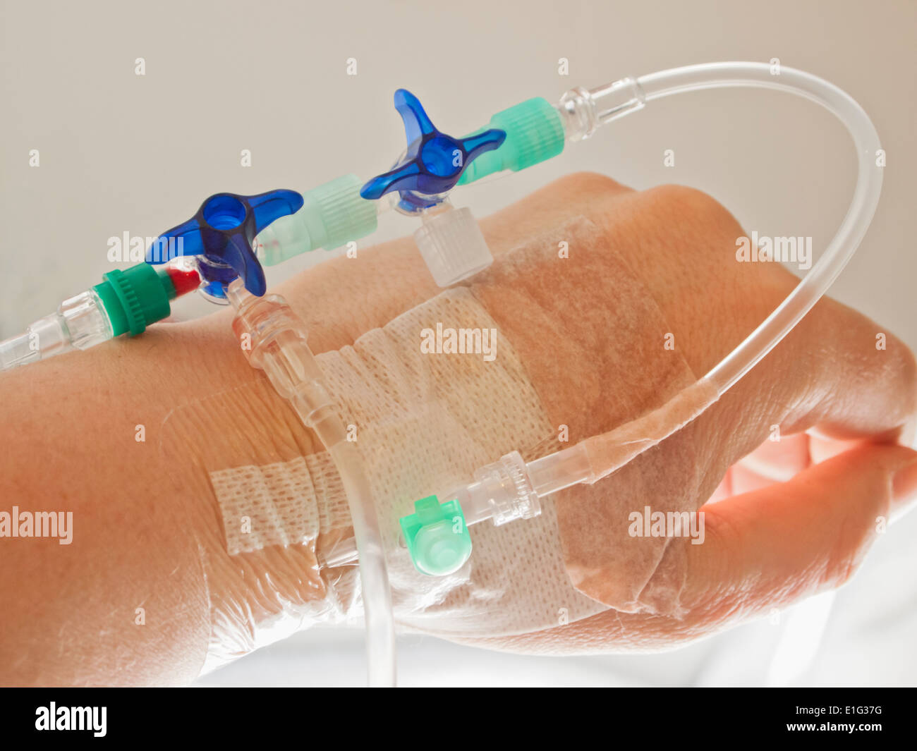 Human hand on IV drip in a hospital Stock Photo