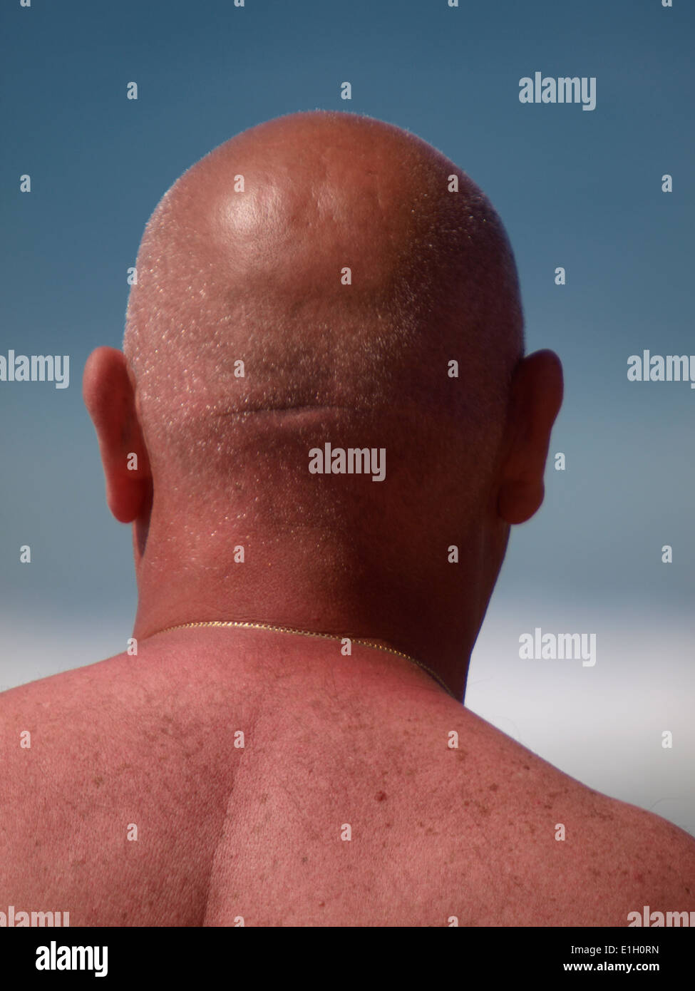 Bald headed man going red in the sun, Cornwall, UK Stock Photo