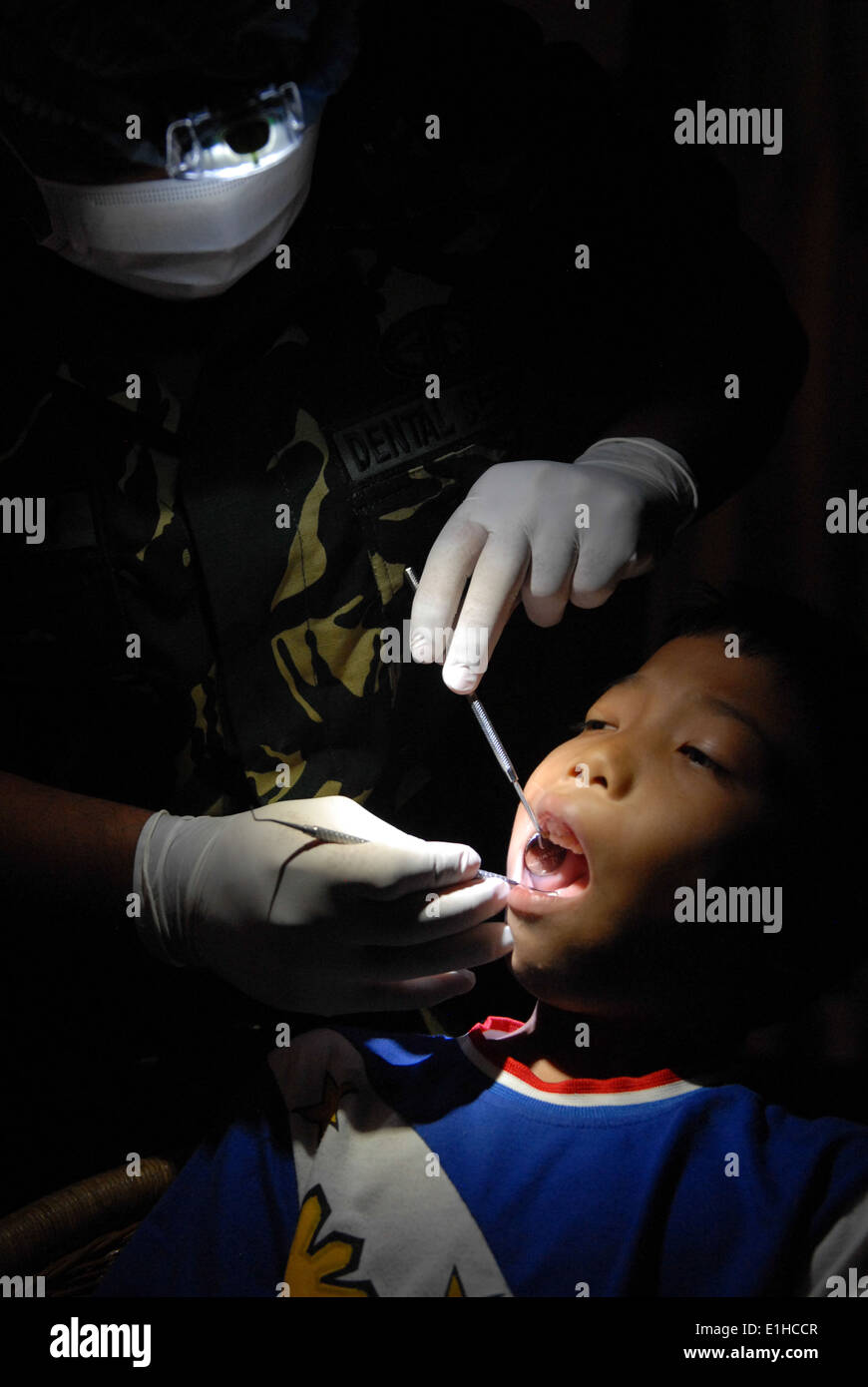 A dentist with the Armed Forces of the Philippines demonstrates how to fill a cavity without drilling or using anesthetic durin Stock Photo