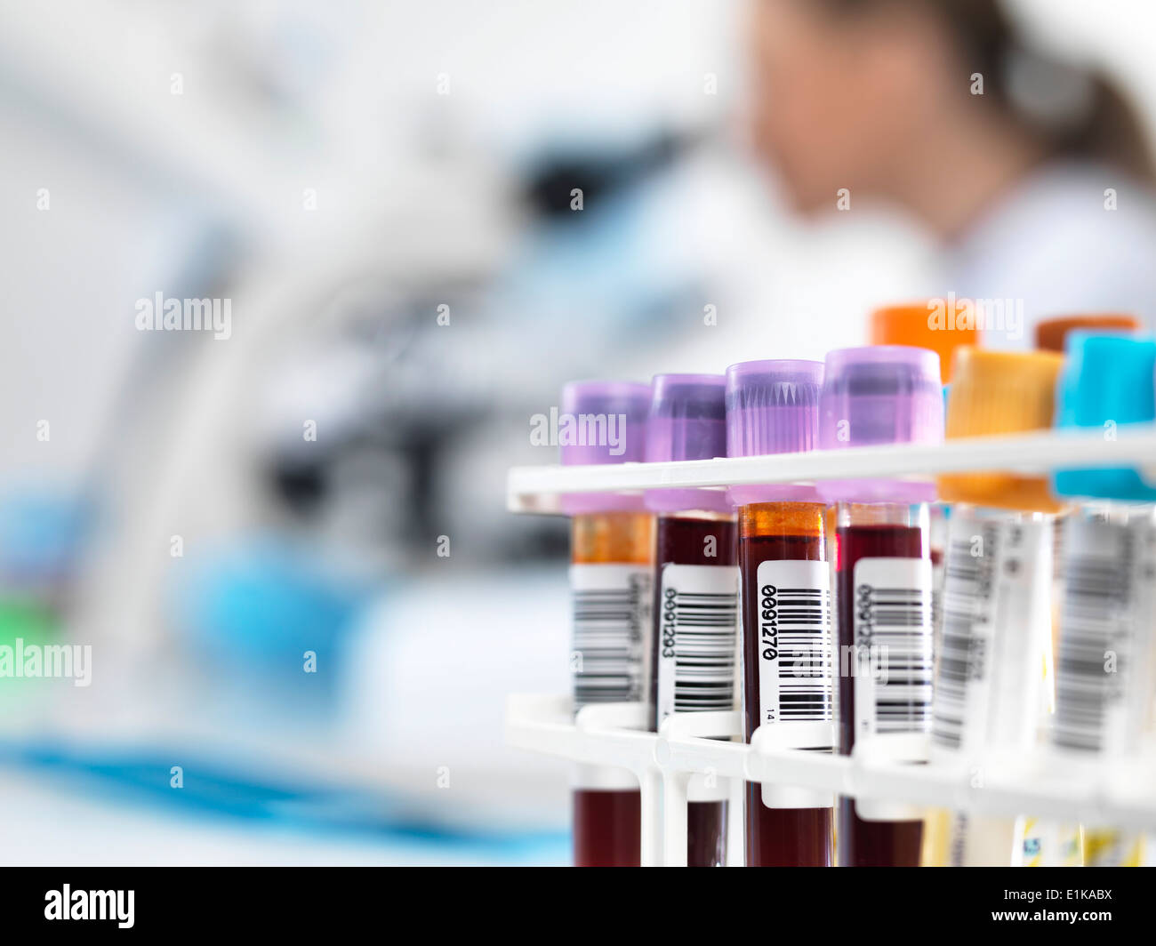 Blood samples in test tube rack with bar codes. Stock Photo