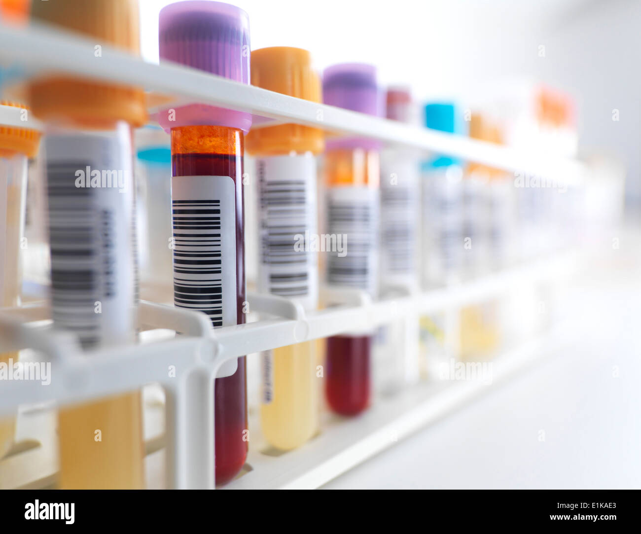 Blood samples in a test tube rack. Stock Photo
