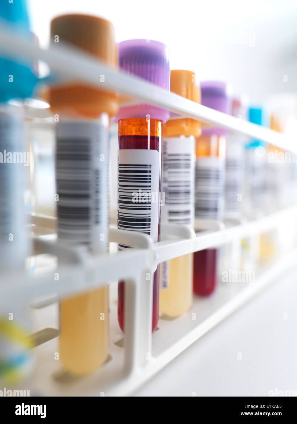 Blood samples in a test tube rack. Stock Photo