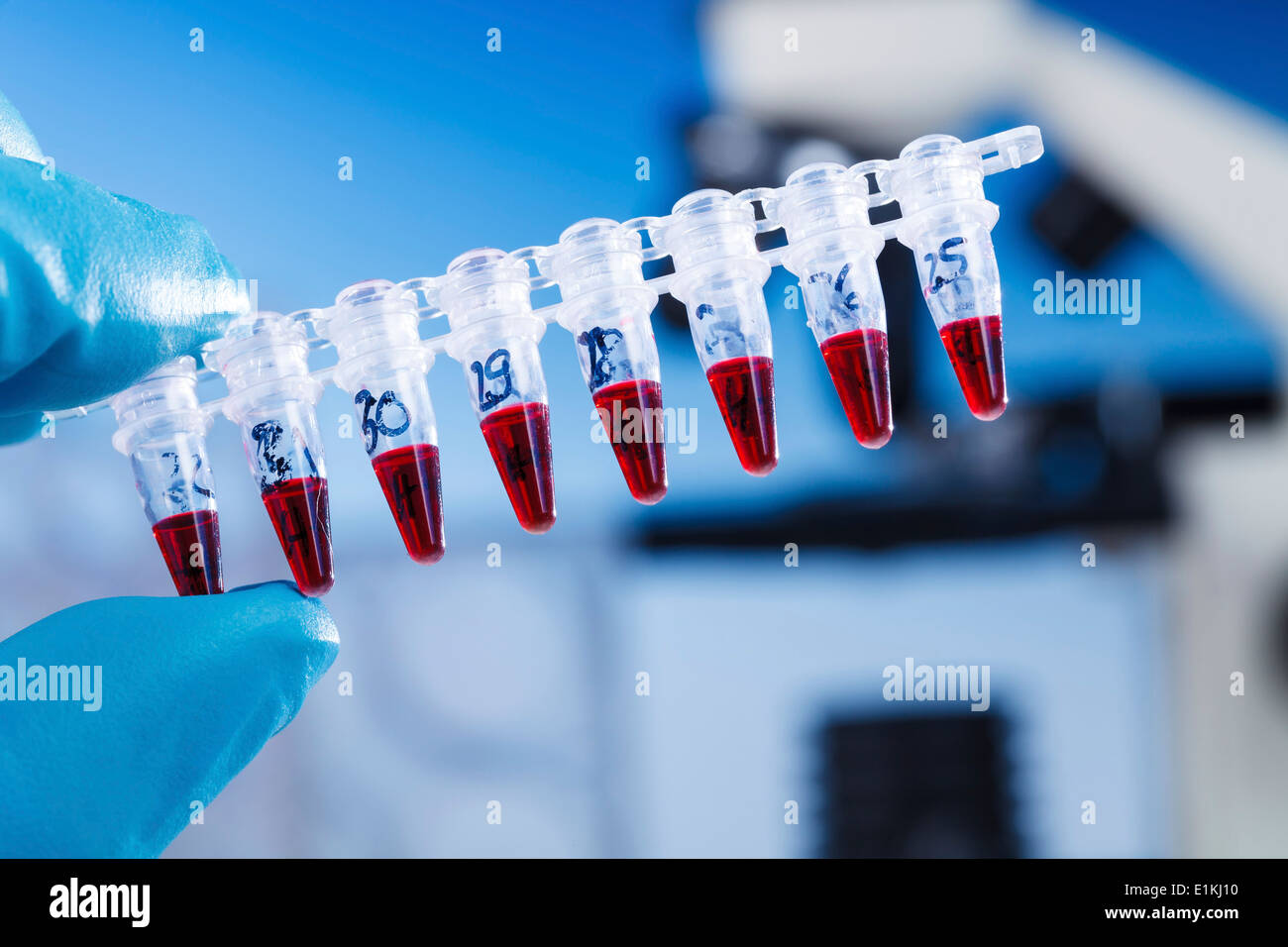 Blood testing equipment Stock Photo Alamy