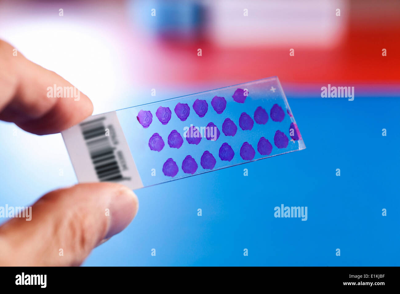 Person holding microscope slide with blood samples Stock Photo Alamy
