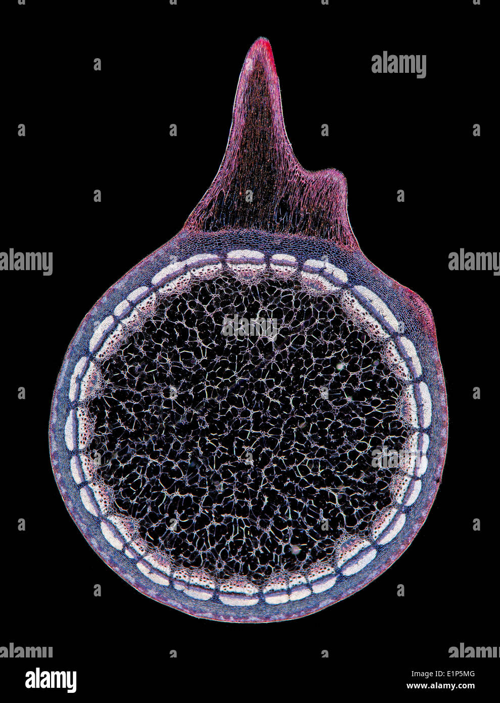 Darkfield photomicrograph of a rose thorn showing general structure