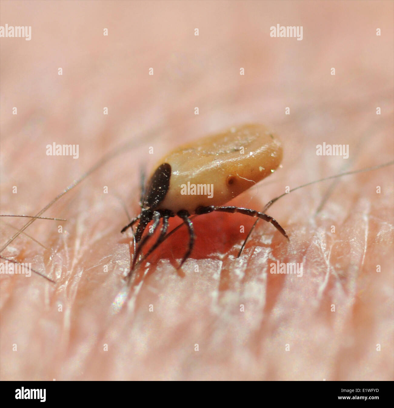 Deer Dog Sheep Tick on human skin cutting to suck blood. Photographer's own hand - no model release required Stock Photo