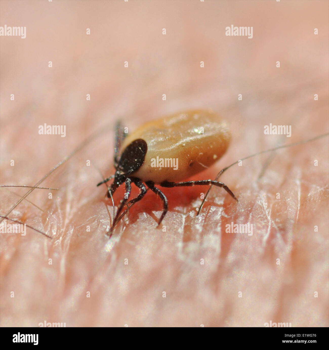 Deer Dog Sheep Tick on human skin cutting to suck blood. Photographer's own hand - no model release required Stock Photo