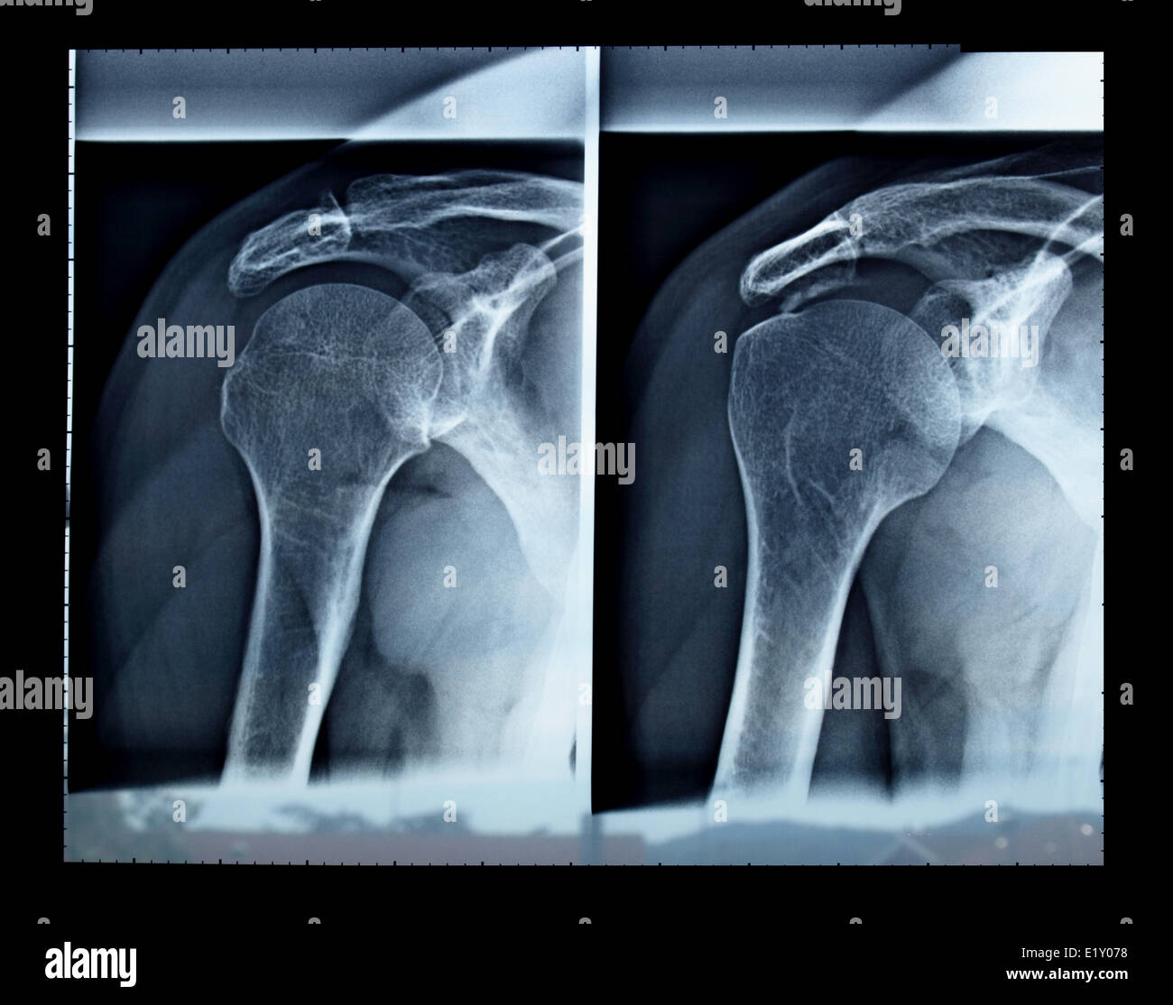 Xray hi-res stock photography and images - Alamy
