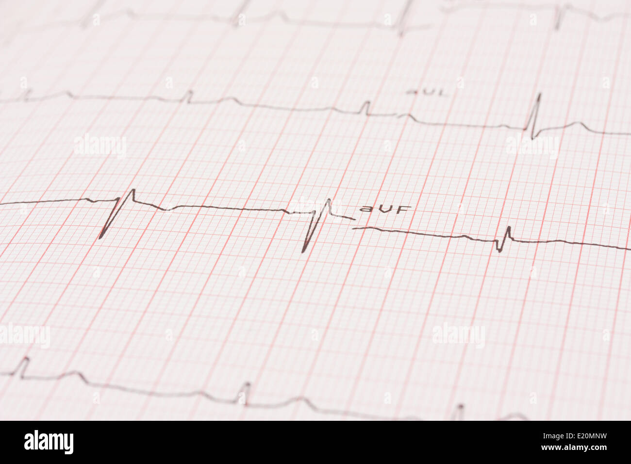 Detail of an electrocardiogram Stock Photo