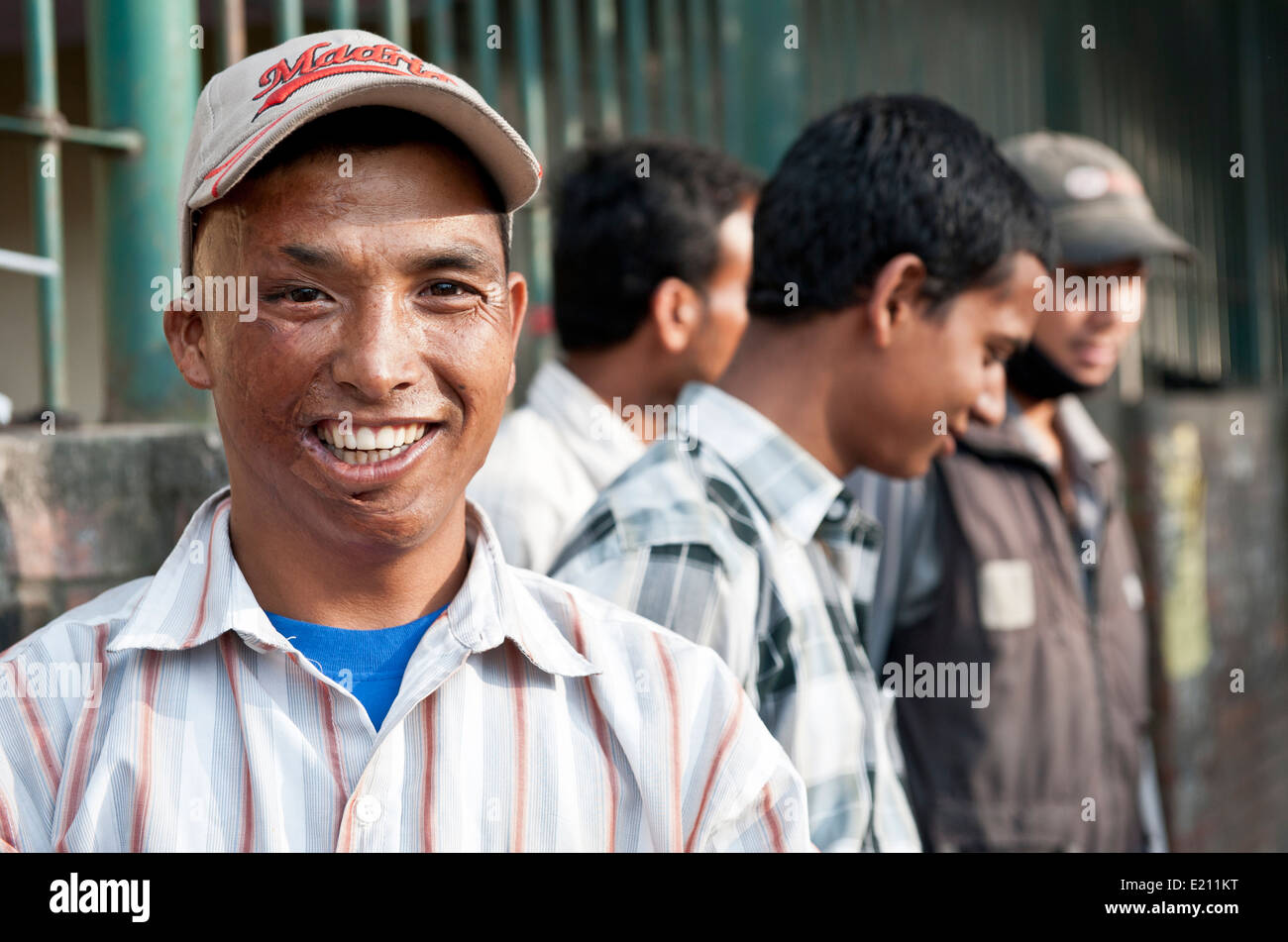 Face of badly burned man smiling at camera in Kathmandu, Nepal Stock Photo