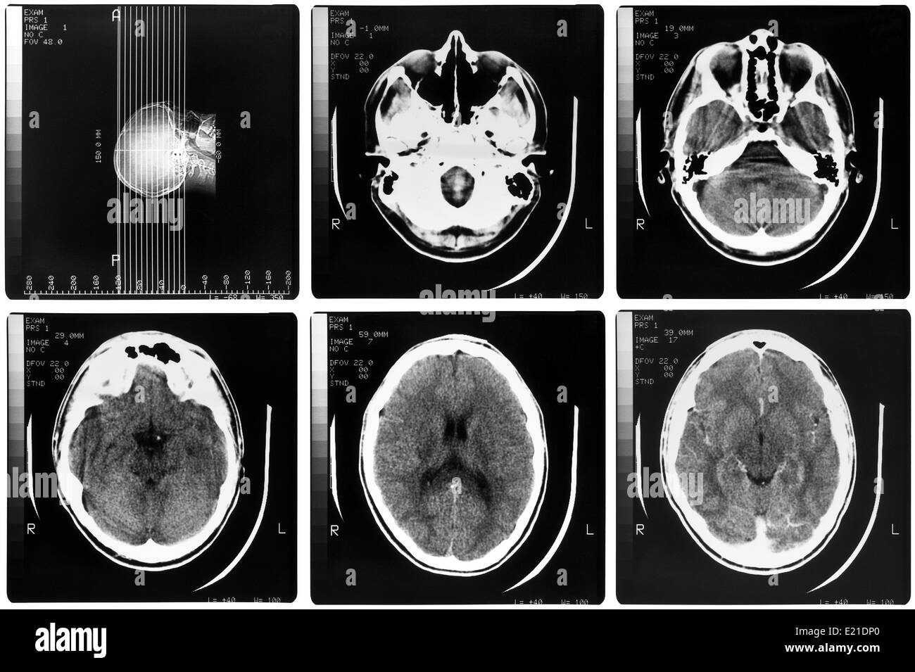 Xray object Black and White Stock Photos & Images Alamy