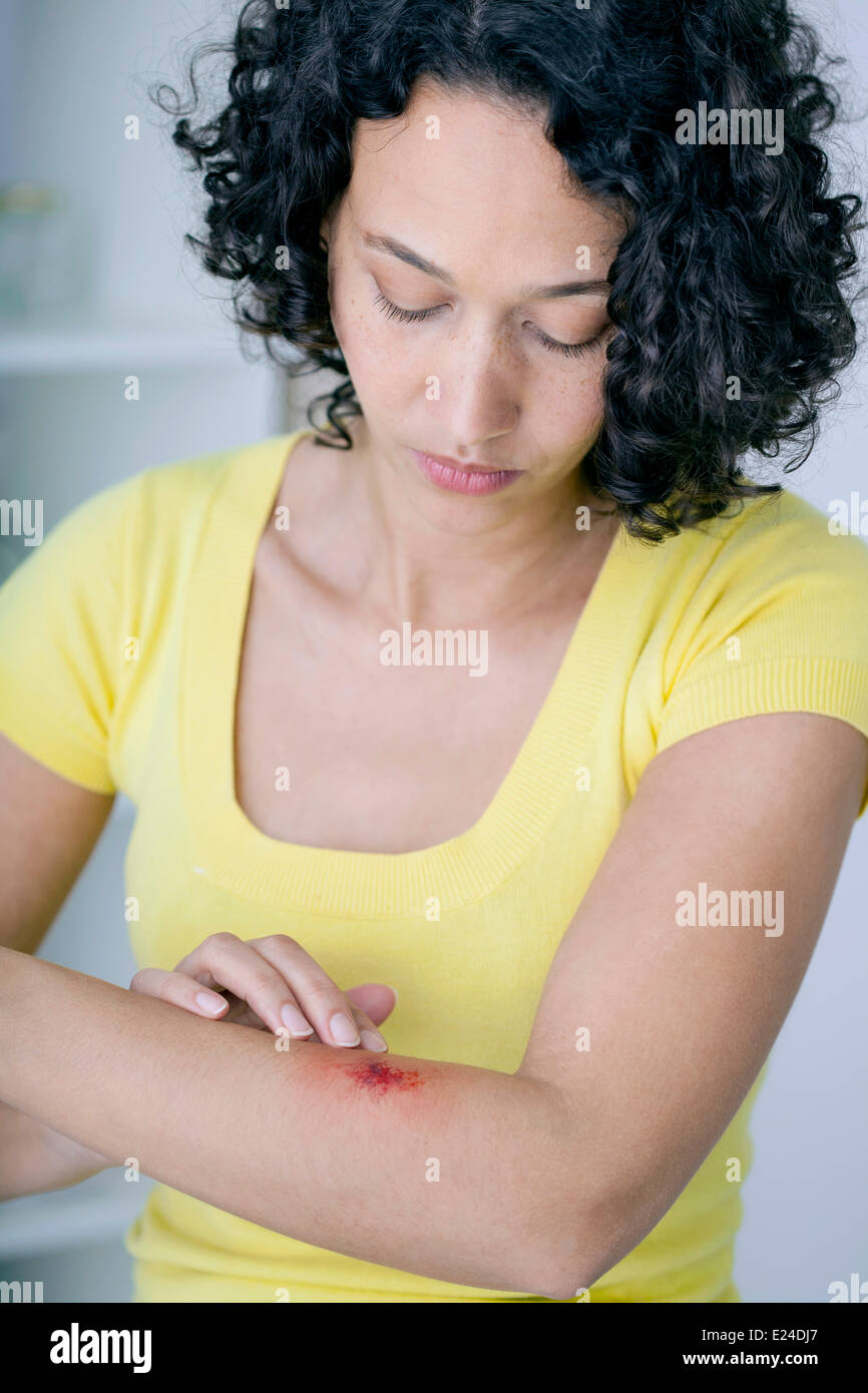 Wound, woman Stock Photo