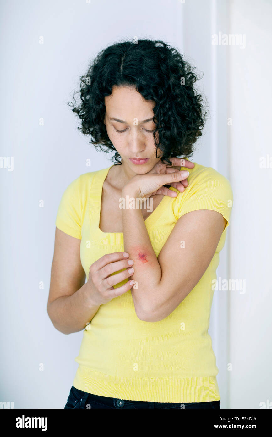 Wound, woman Stock Photo