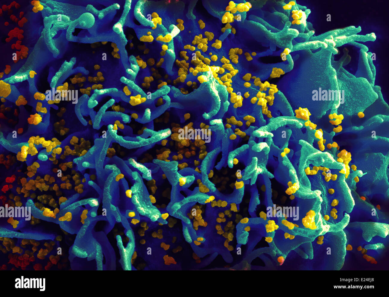 Hiv-infected h9 t-cell Stock Photo