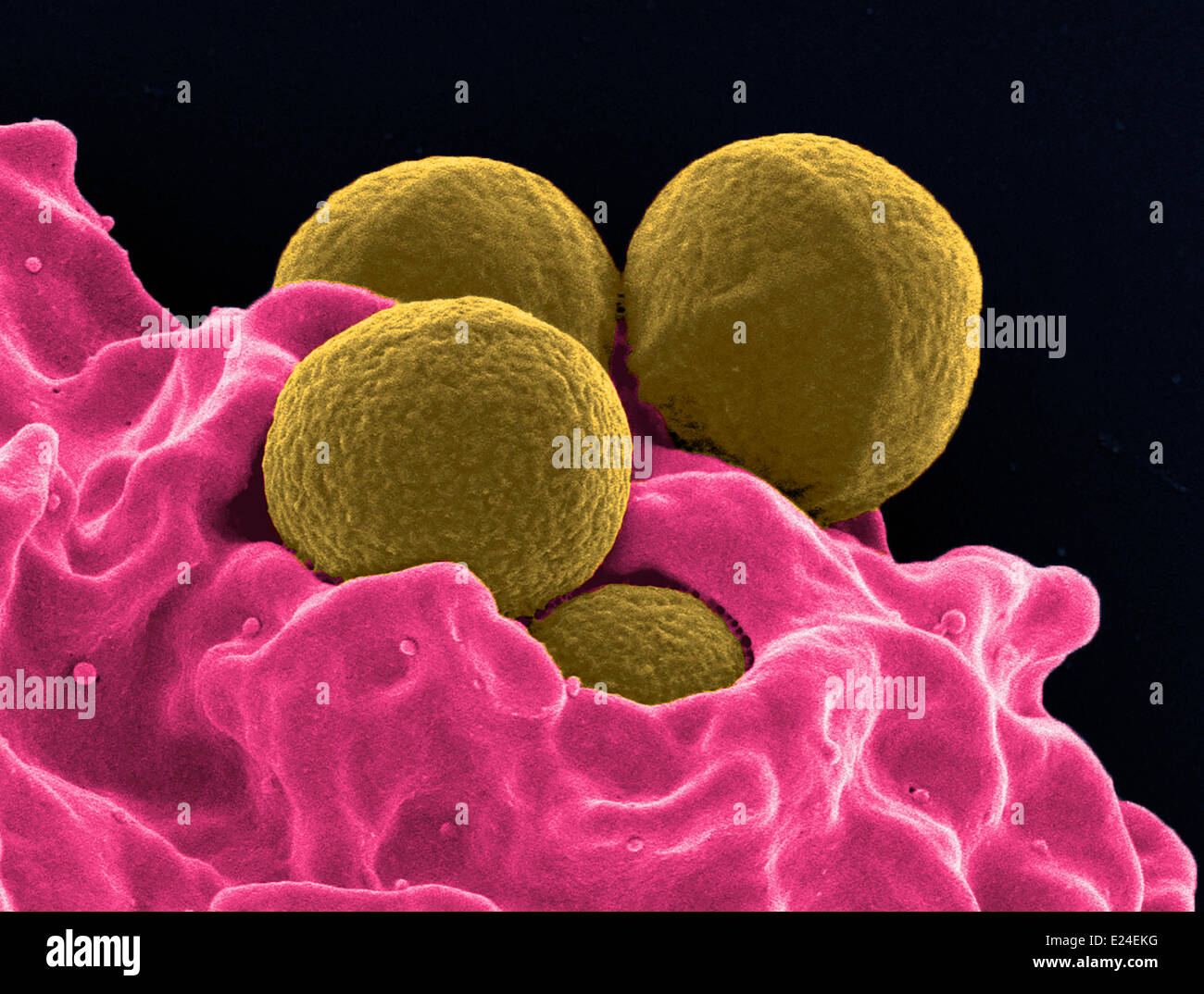 Human neutrophil ingesting mrsa Stock Photo