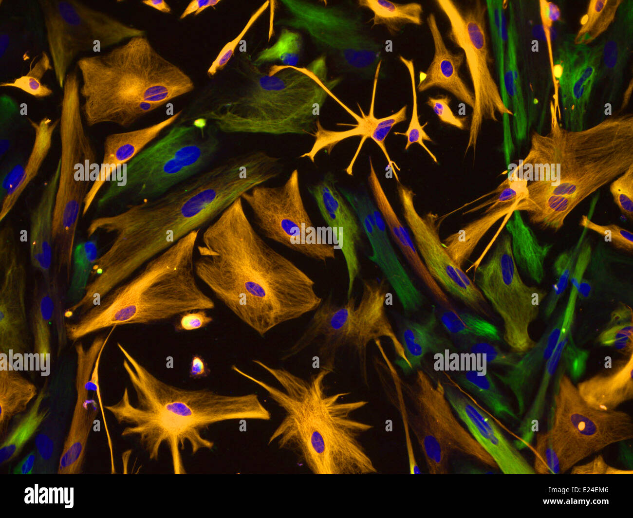Directed differentiation of multipotential human neural progenitor cells Stock Photo