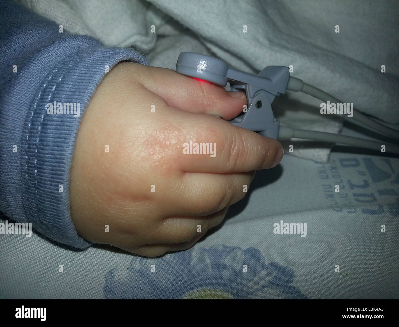 baby connected to a pulse oximeter on his finger. Pulse oximeters