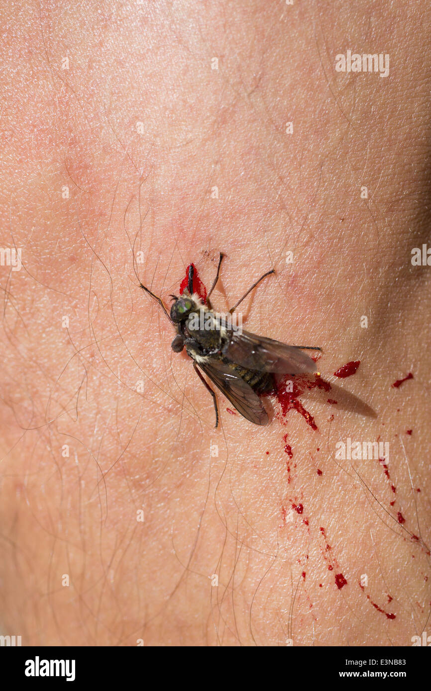 Close-up of dead housefly on skin Stock Photo