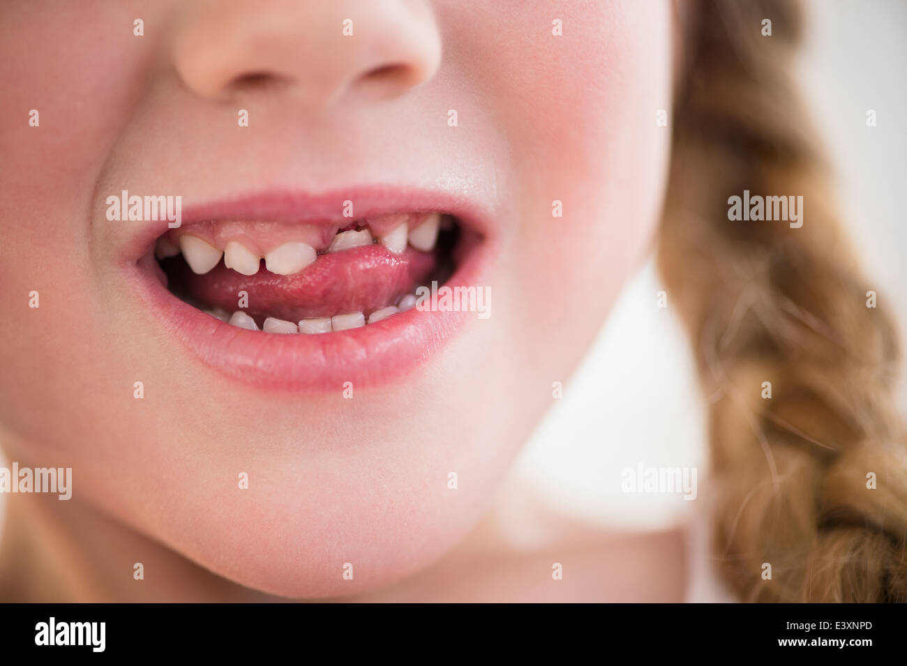 Caucasian girl wiggling loose tooth Stock Photo