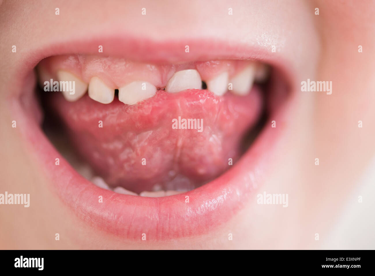 Caucasian girl wiggling loose tooth Stock Photo