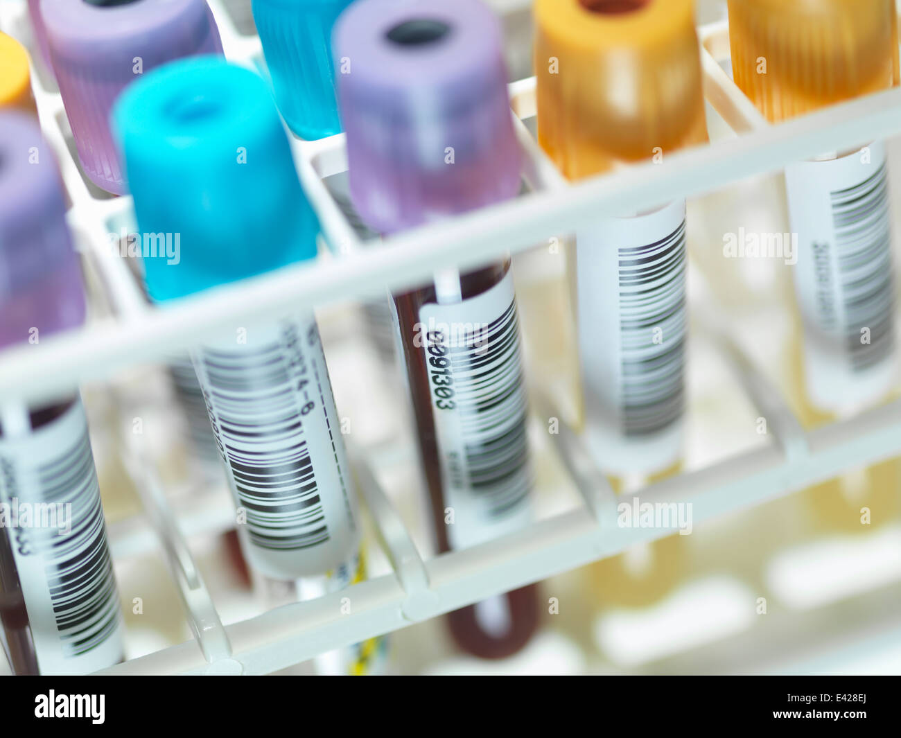 A row of human blood and chemistry samples awaiting testing in the lab Stock Photo