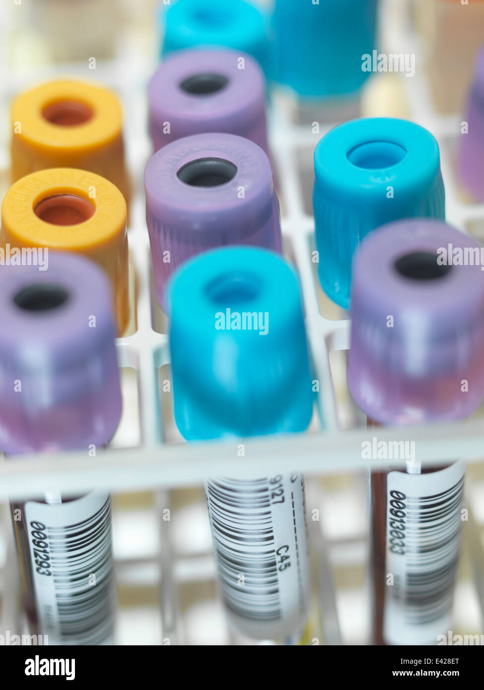 A row of human blood and chemistry samples awaiting testing in the lab Stock Photo
