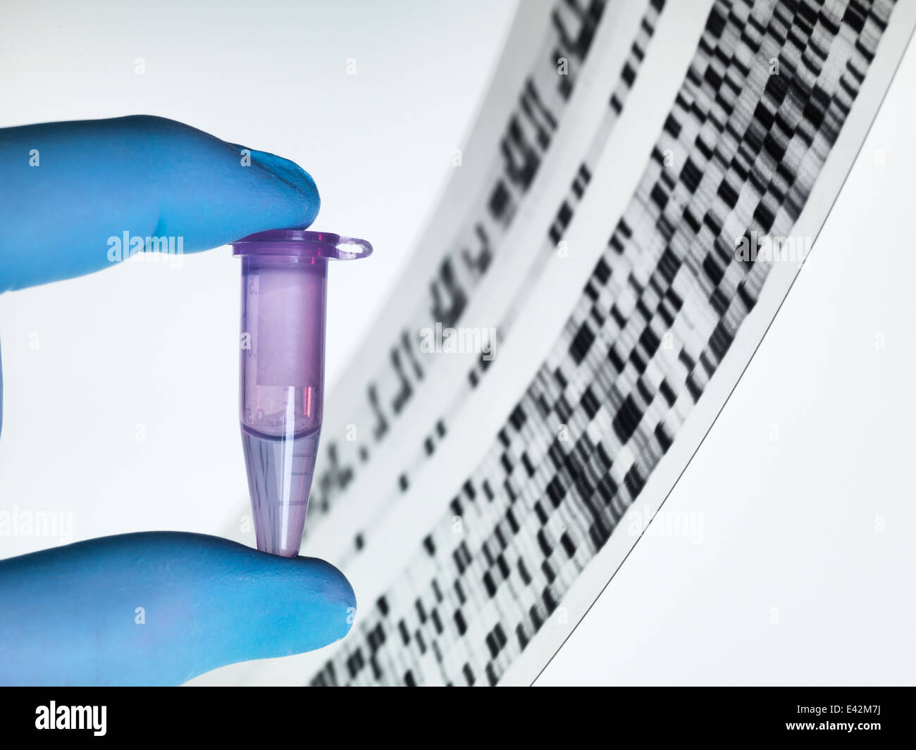Genetic sample and DNA autoradiogram Stock Photo