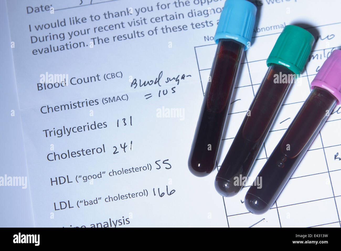 Test tube blood on cholesterol hires stock photography and images Alamy