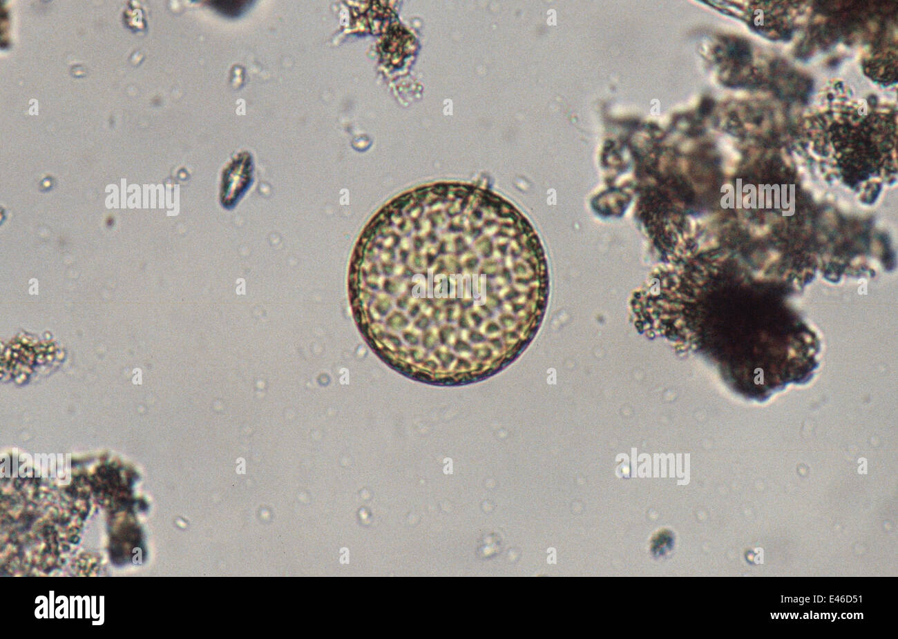 Phytoplankton diatom. Australia Queenscliff Stock Photo