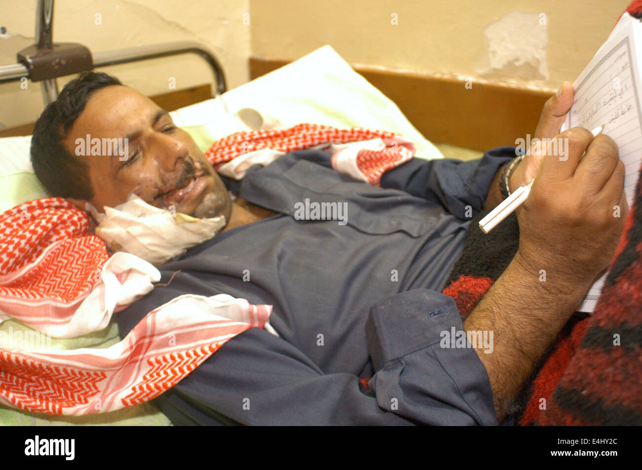 Al-Kharj Hospital. In one of the operating rooms, an Iraqi surgeon and his medical team comes for the extraction of a low caliber bullet that remains lodged in the jaw Karim. Stock Photo