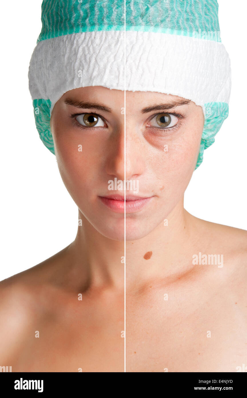 Before after beauty skin hi-res stock photography and images - Alamy