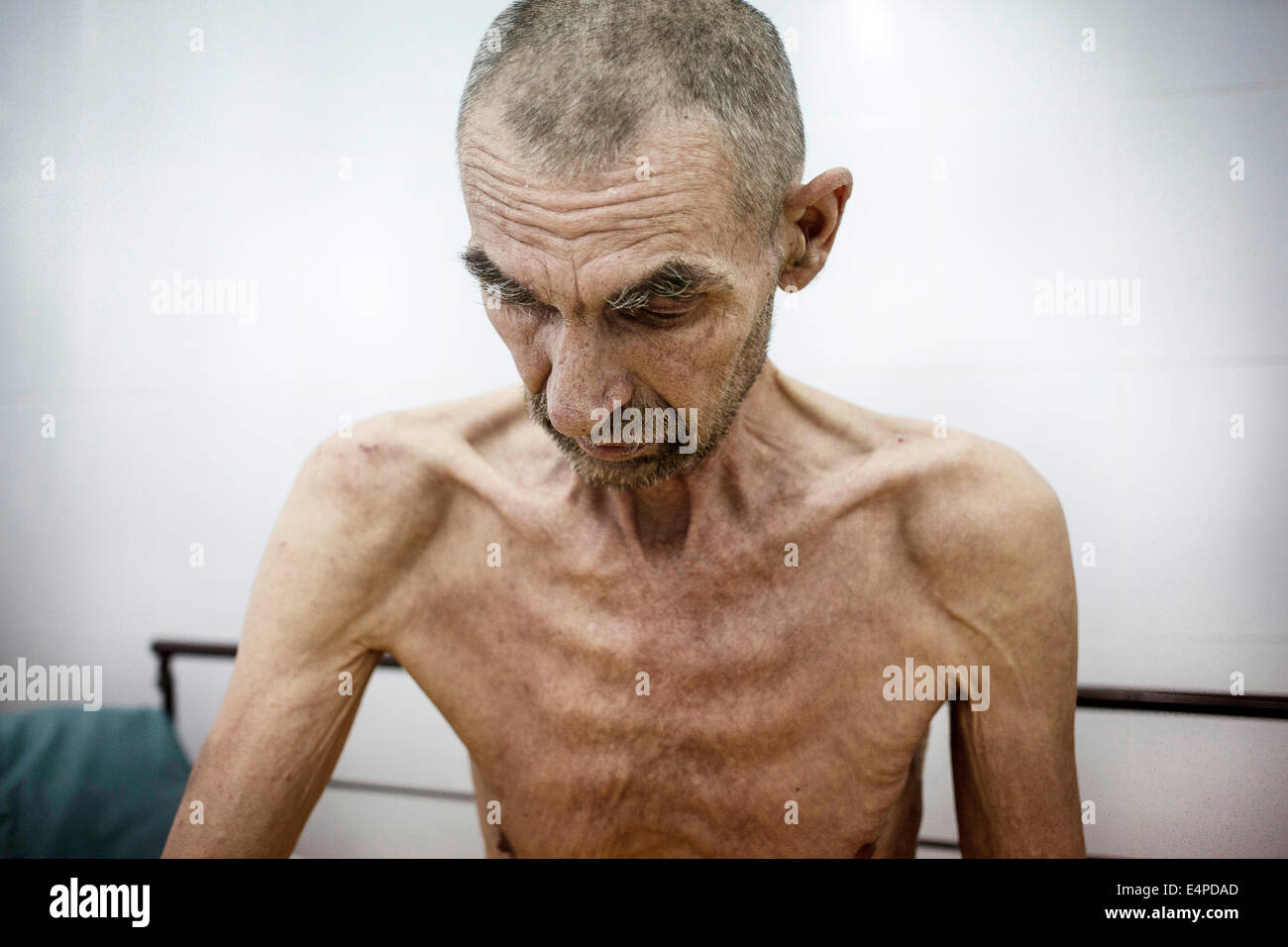 Sick with aids in the hospital hi-res stock photography and images - Alamy