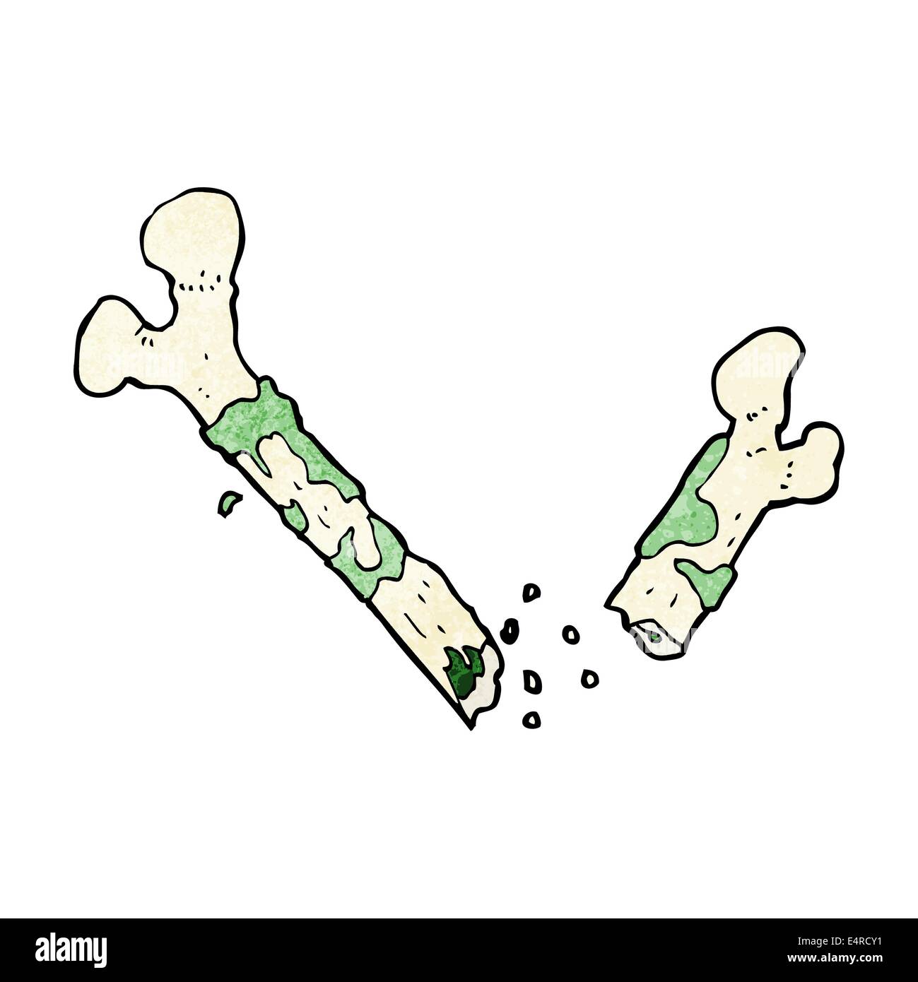 gross broken bone cartoon Stock Vector Image & Art - Alamy
